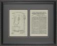Blood Pressure Cuff Patent Art - 16x20
